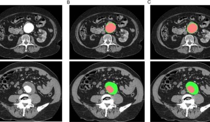 Precision medical scan